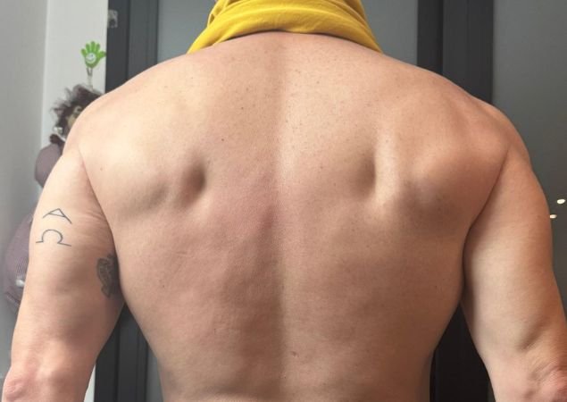 Rio-Fit-Antes y Despues-Henrique (2) Rio-Fit-Antes y Despues-Henrique (2)